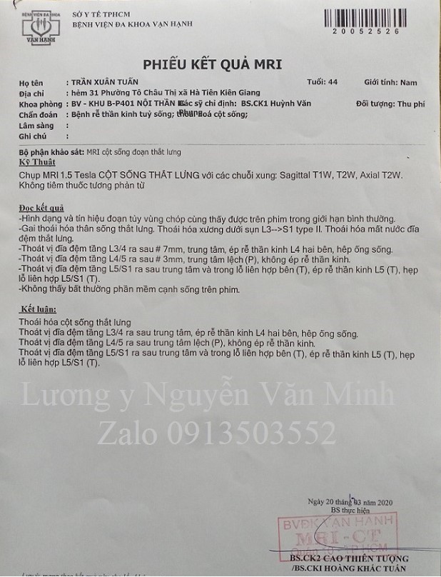 Thoát vị đĩa đệm L3/L4, L4/L5, L5/S1